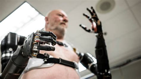 Bionic Human Review 2024